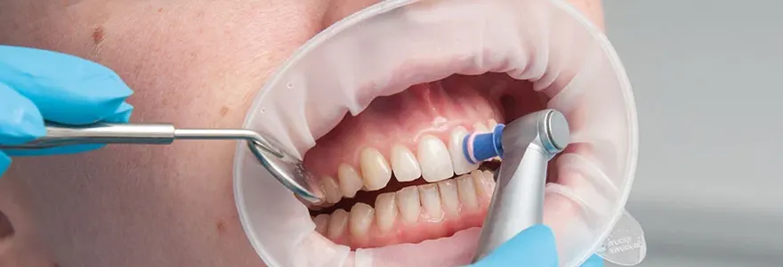 quelques astuces pour vous aider a avoir une meilleure dentition