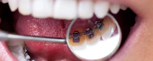 orthodontie corrective