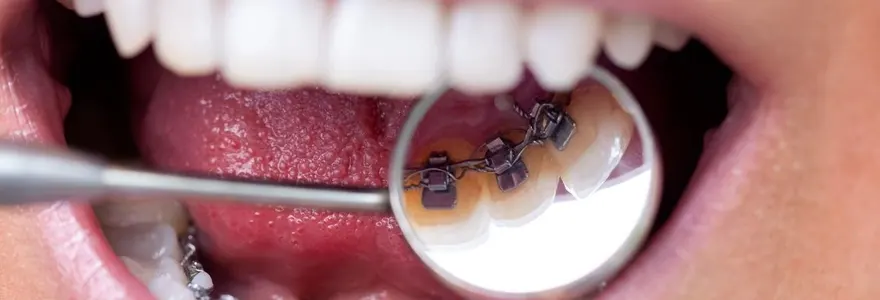 orthodontie corrective
