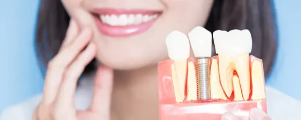 comment choisir la meilleure mutuelle dentaire pour le remboursement d un implant dentaire