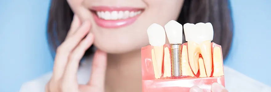 comment choisir la meilleure mutuelle dentaire pour le remboursement d un implant dentaire