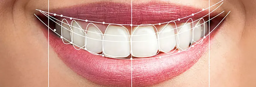 les avantages de la dentisterie esthetique pour une apparence radieuse